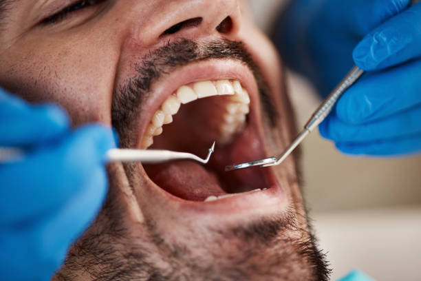 Best Emergency TMJ Treatment in Brookdale, CA